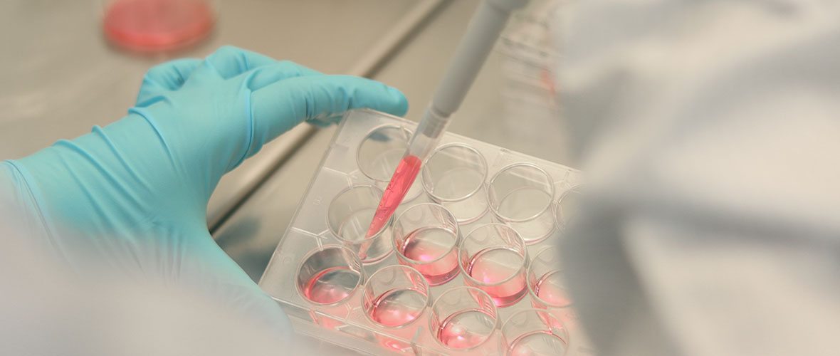 Scientist working in laboratory, microbiologist's hand with gloves holding a pipette, preparing culture media for cell culture